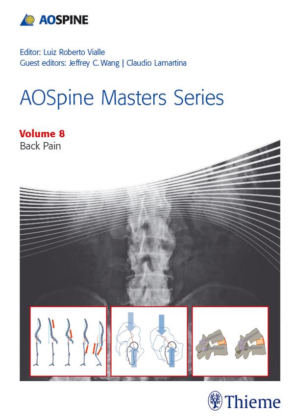 AOSpine Masters Series Volume 8: Back Pain