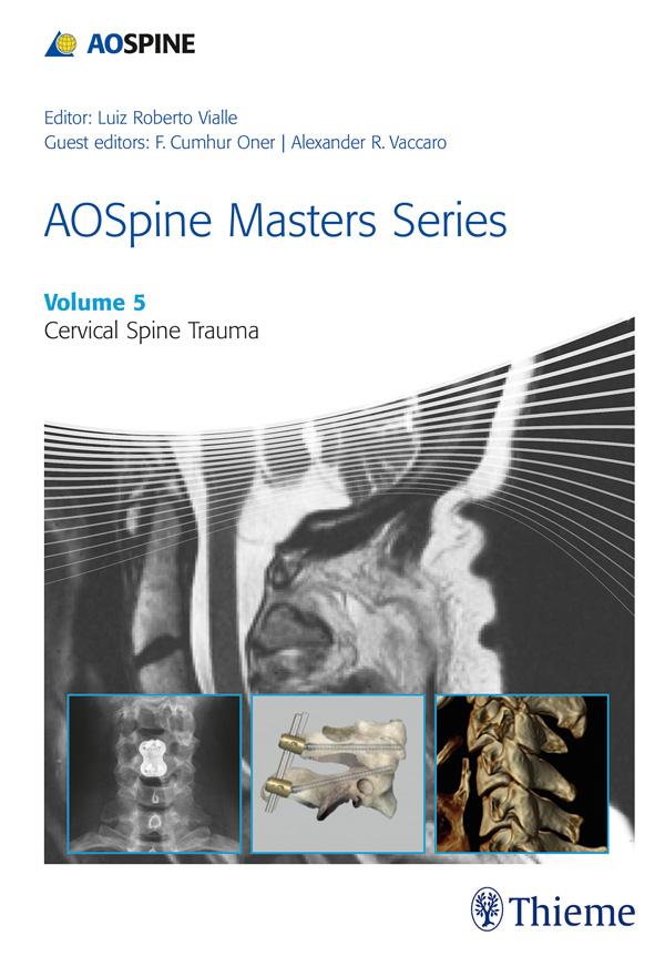 AOSpine Masters Series Volume 5: Cervical Spine Trauma