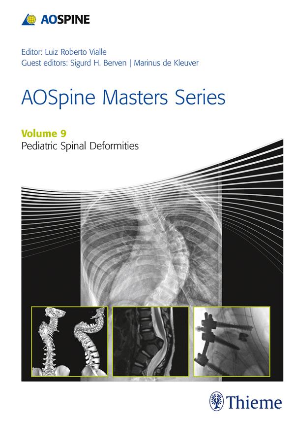 AOSpine Masters Series Volume 9: Pediatric Spinal Deformities