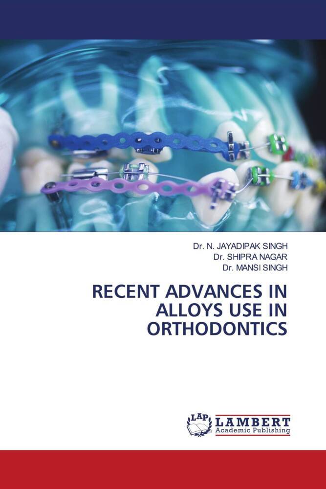 RECENT ADVANCES IN ALLOYS USE IN ORTHODONTICS