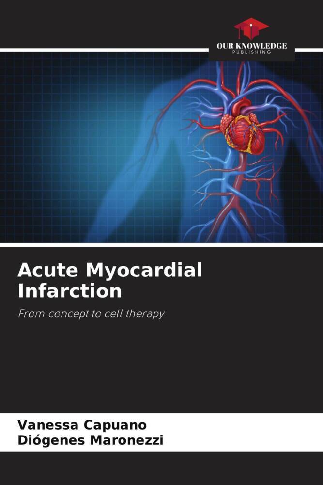 Acute Myocardial Infarction