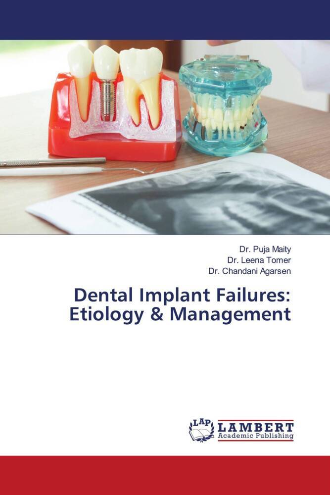 Dental Implant Failures: Etiology & Management