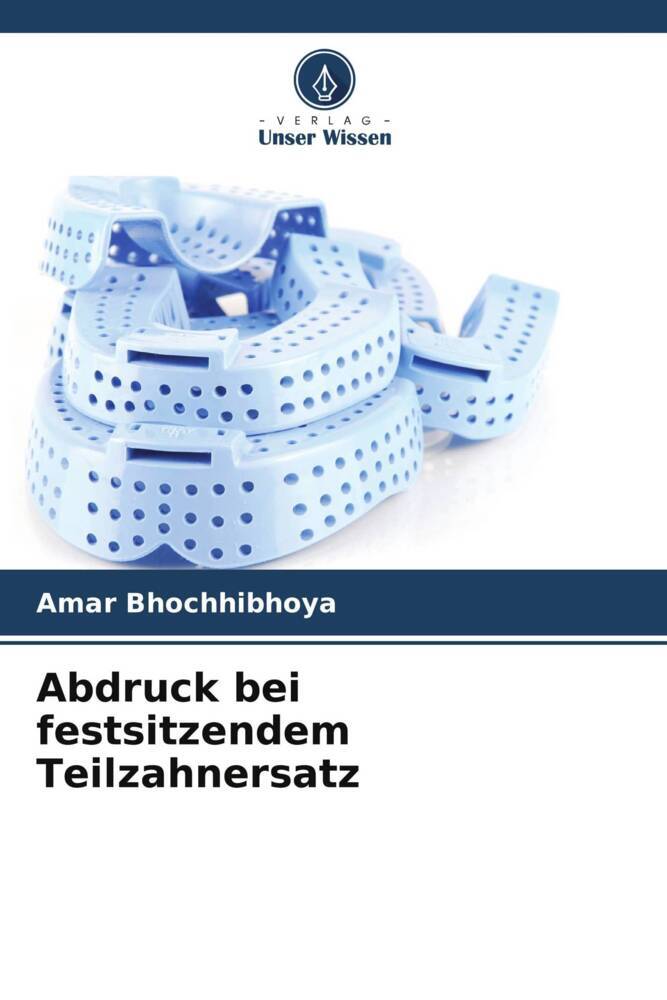 Abdruck bei festsitzendem Teilzahnersatz