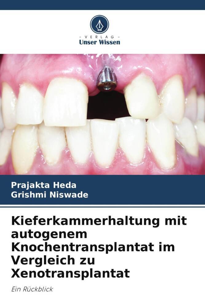 Kieferkammerhaltung mit autogenem Knochentransplantat im Vergleich zu Xenotransplantat