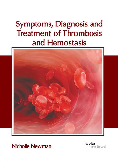 Symptoms Diagnosis and Treatment of Thrombosis and Hemostasis
