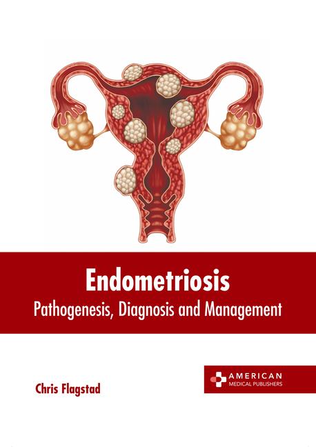 Endometriosis: Pathogenesis Diagnosis and Management