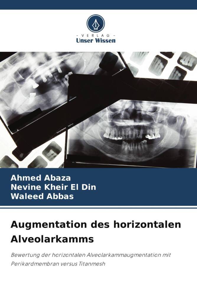 Augmentation des horizontalen Alveolarkamms
