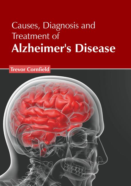 Causes Diagnosis and Treatment of Alzheimer‘s Disease