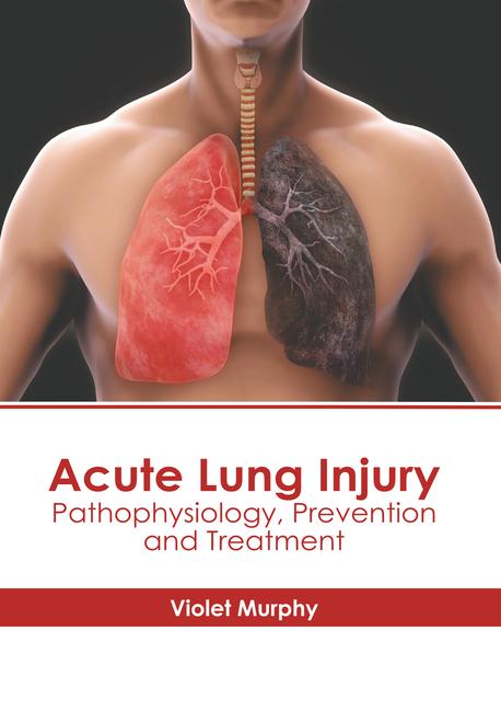 Acute Lung Injury: Pathophysiology Prevention and Treatment