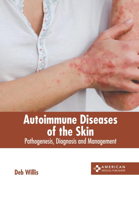 Autoimmune Diseases of the Skin: Pathogenesis Diagnosis and Management