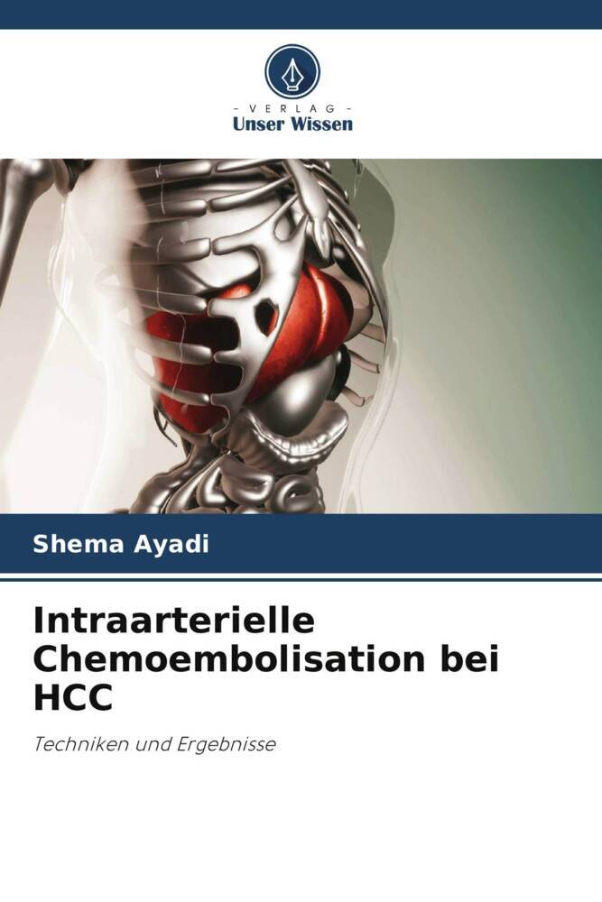 Intraarterielle Chemoembolisation bei HCC