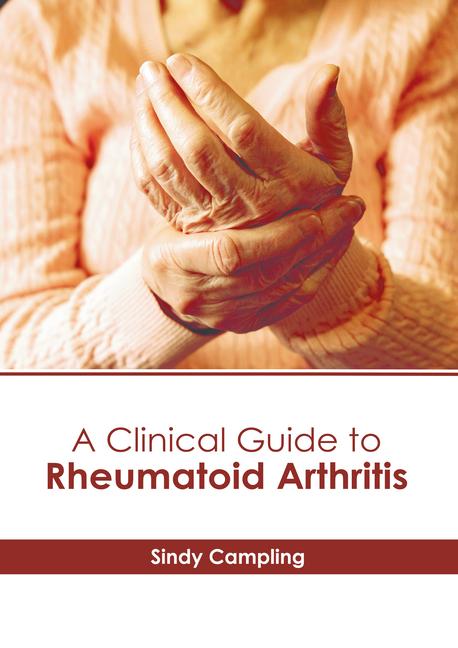 A Clinical Guide to Rheumatoid Arthritis