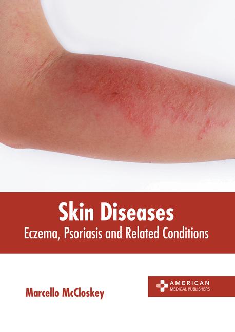 Skin Diseases: Eczema Psoriasis and Related Conditions