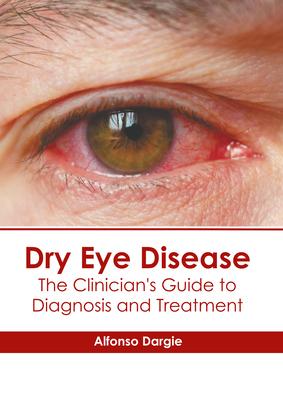 Dry Eye Disease: The Clinician‘s Guide to Diagnosis and Treatment