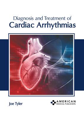 Diagnosis and Treatment of Cardiac Arrhythmias