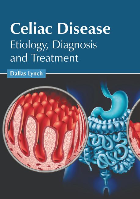 Celiac Disease: Etiology Diagnosis and Treatment