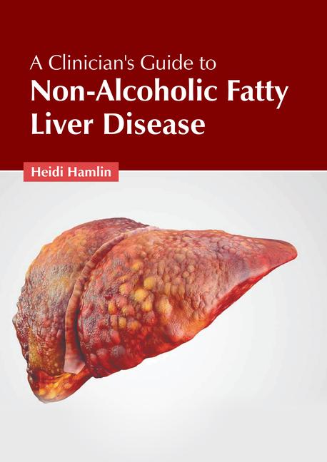 A Clinician‘s Guide to Non-Alcoholic Fatty Liver Disease