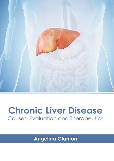 Chronic Liver Disease: Causes Evaluation and Therapeutics