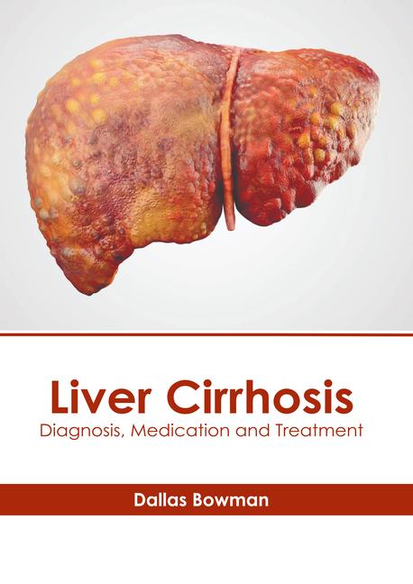 Liver Cirrhosis: Diagnosis Medication and Treatment