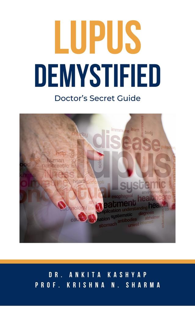 Lupus Demystified: Doctor‘s Secret Guide