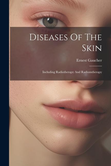Diseases Of The Skin: Including Radiotherapy And Radiumtherapy