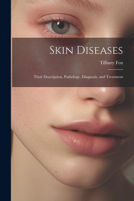 Skin Diseases: Their Description Pathology Diagnosis and Treatment