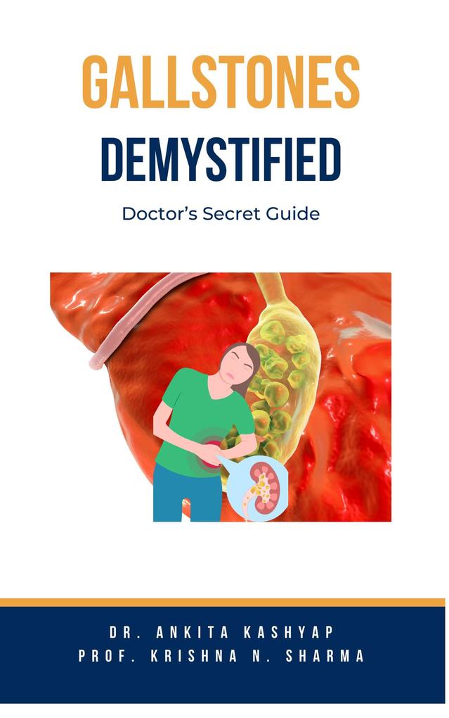 Gallstones Demystified: Doctor‘s Secret Guide