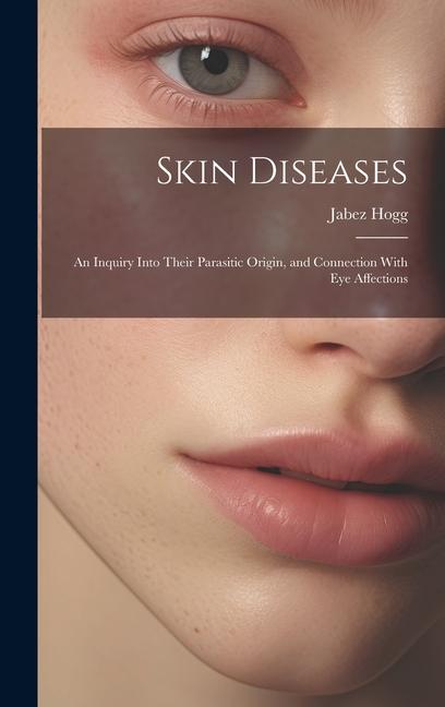 Skin Diseases; An Inquiry Into Their Parasitic Origin and Connection With Eye Affections