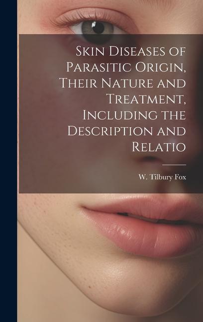 Skin Diseases of Parasitic Origin Their Nature and Treatment Including the Description and Relatio