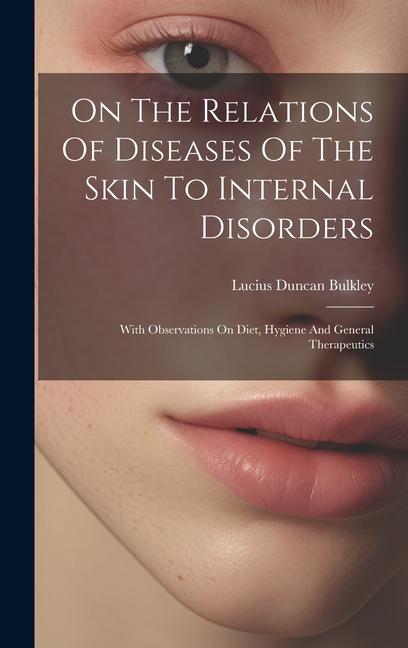 On The Relations Of Diseases Of The Skin To Internal Disorders: With Observations On Diet Hygiene And General Therapeutics