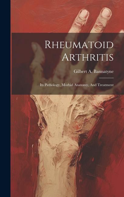 Rheumatoid Arthritis: Its Pathology Morbid Anatomy And Treatment