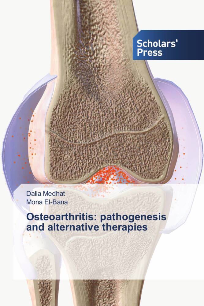 Osteoarthritis: pathogenesis and alternative therapies