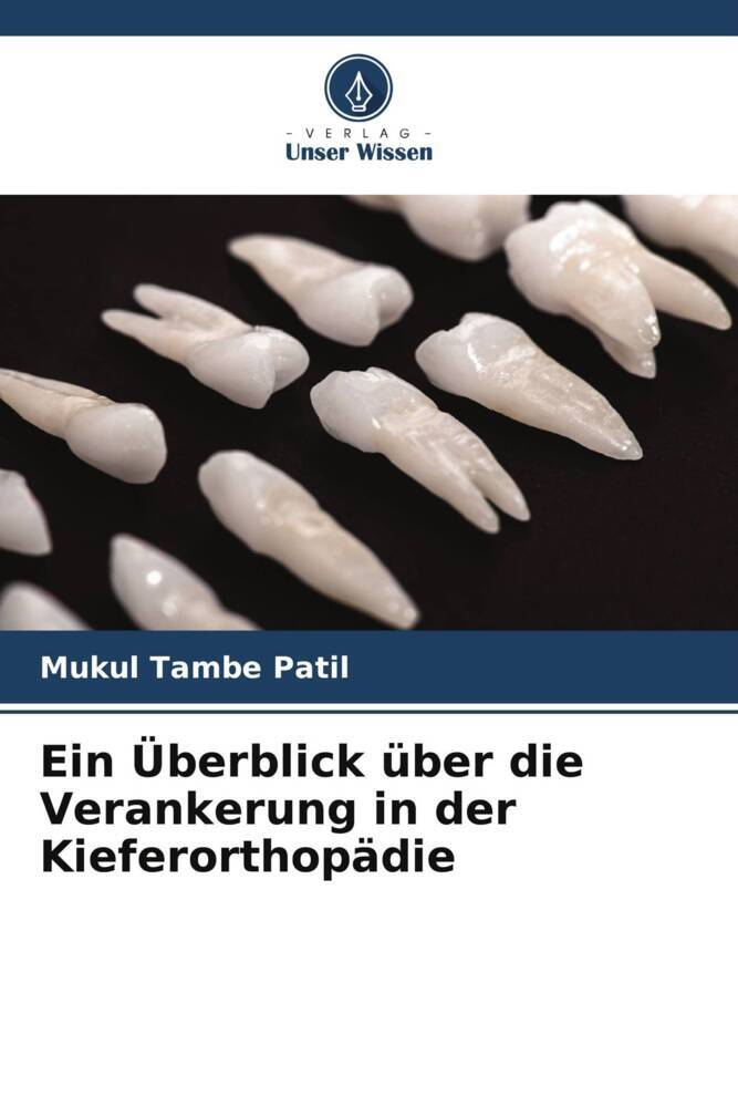 Ein Überblick über die Verankerung in der Kieferorthopädie