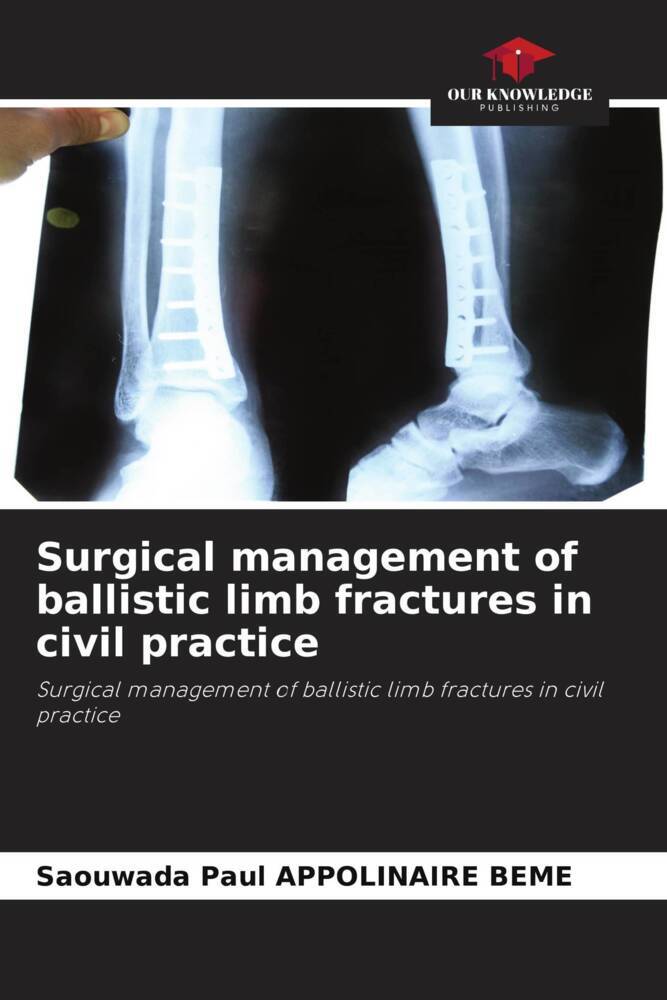 Surgical management of ballistic limb fractures in civil practice
