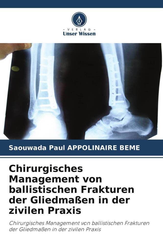 Chirurgisches Management von ballistischen Frakturen der Gliedmaßen in der zivilen Praxis