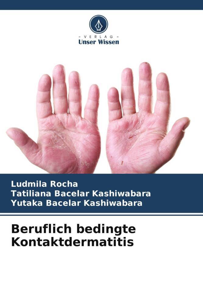 Beruflich bedingte Kontaktdermatitis