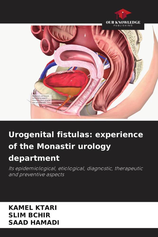Urogenital fistulas: experience of the Monastir urology department