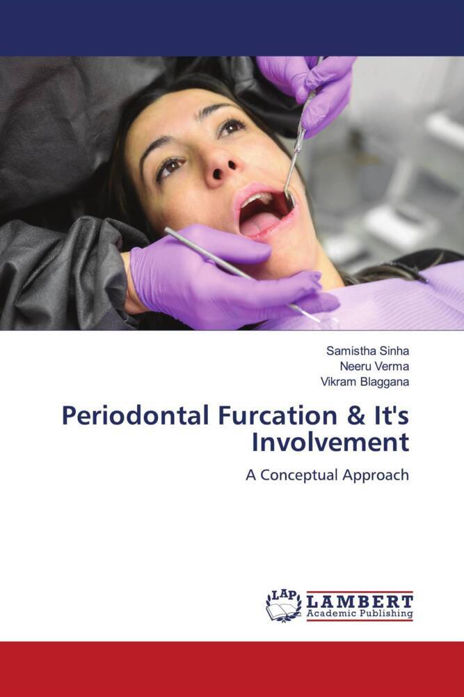 Periodontal Furcation & It's Involvement