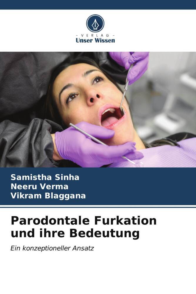 Parodontale Furkation und ihre Bedeutung