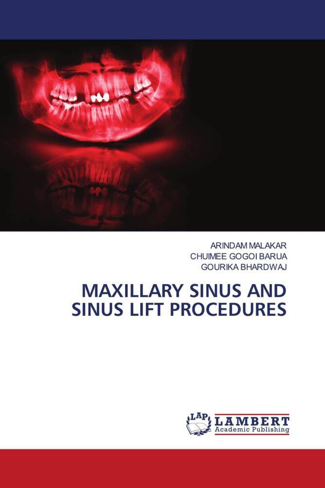MAXILLARY SINUS AND SINUS LIFT PROCEDURES