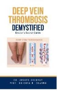 Deep Vein Thrombosis Demystified: Doctor‘s Secret Guide