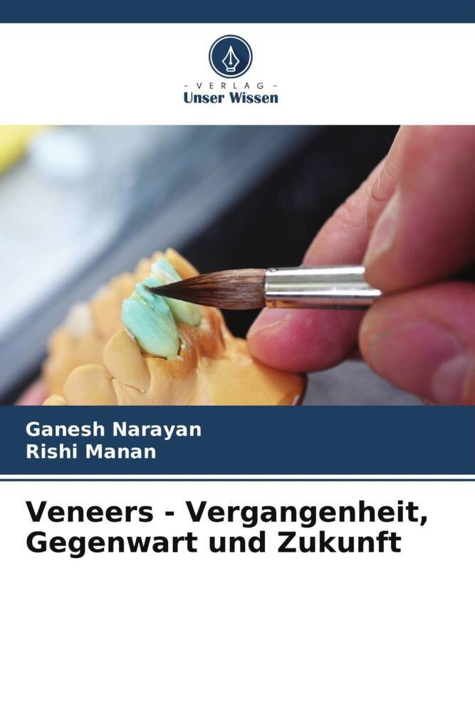 Veneers - Vergangenheit Gegenwart und Zukunft
