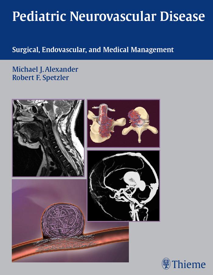 Pediatric Neurovascular Disease