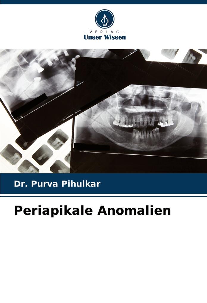 Periapikale Anomalien