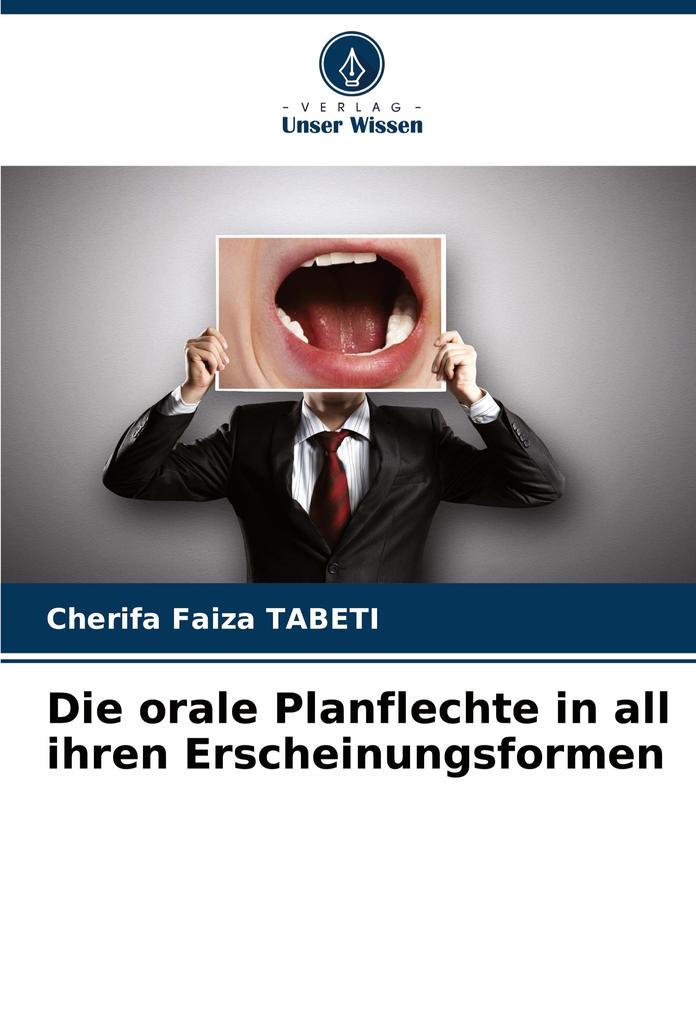 Die orale Planflechte in all ihren Erscheinungsformen