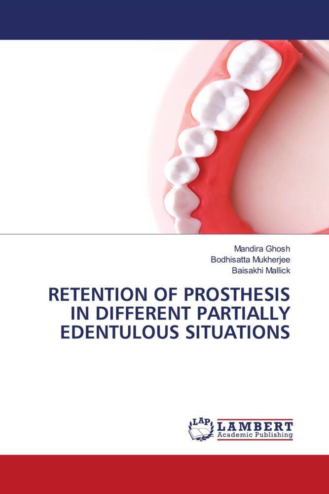 RETENTION OF PROSTHESIS IN DIFFERENT PARTIALLY EDENTULOUS SITUATIONS