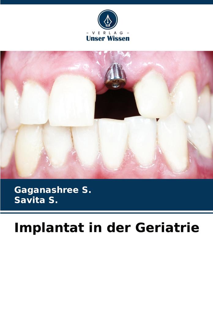 Implantat in der Geriatrie