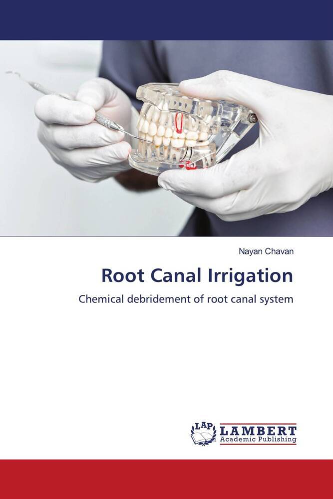 Root Canal Irrigation