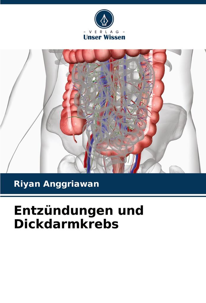 Entzündungen und Dickdarmkrebs