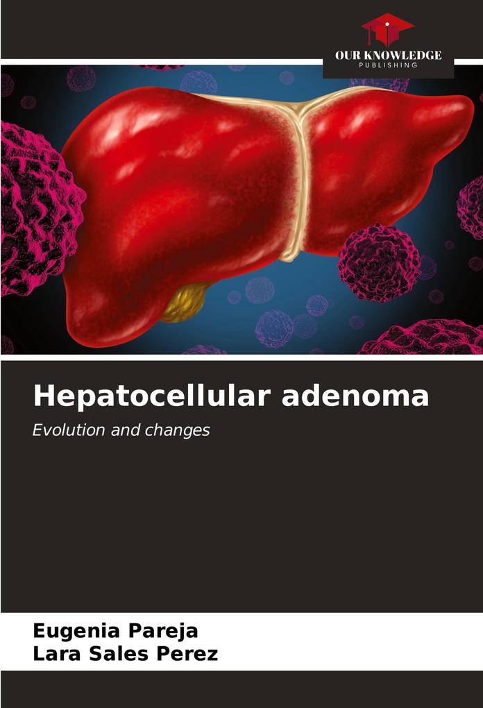 Hepatocellular adenoma